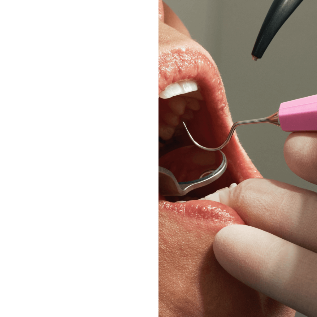 Implante dental Granada