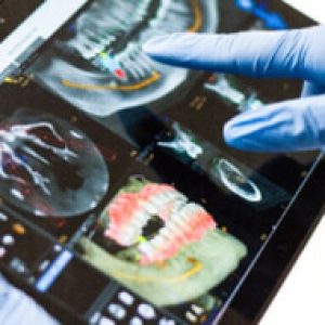 Implante dental Granada