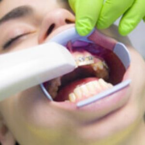 Ortodoncia invisible Granada